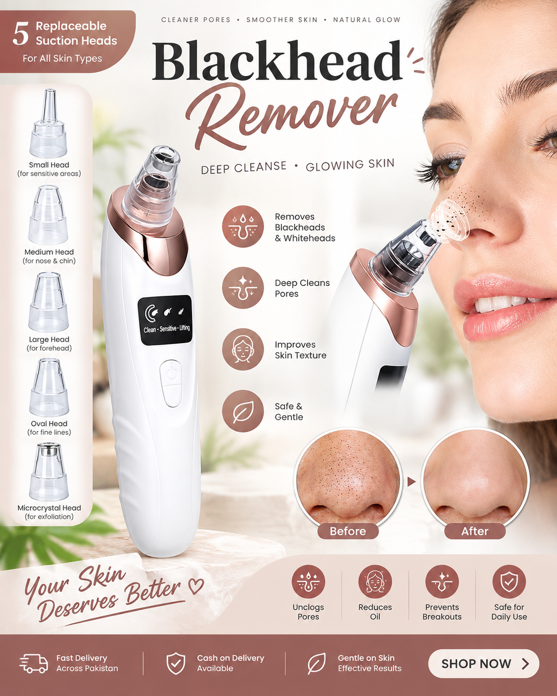 5-in-1 Rechargeable Blackhead Remover Machine – Facial Vacuum Pore Cleaner